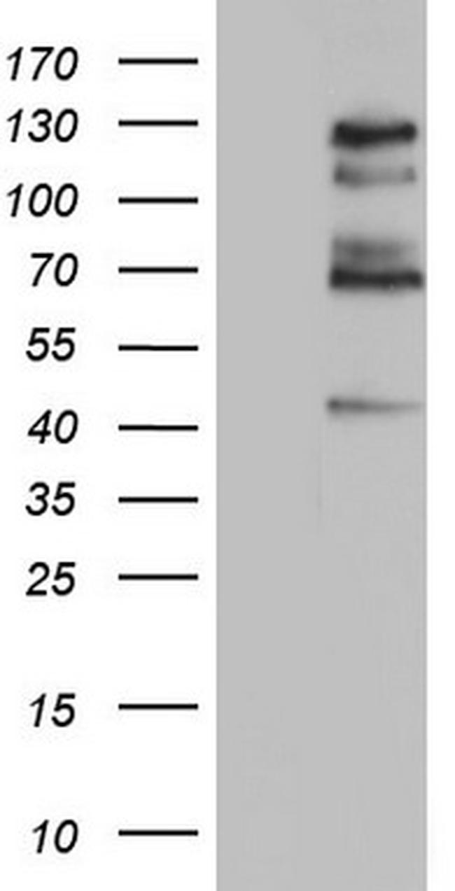 GLI1 Antibody in Western Blot (WB)