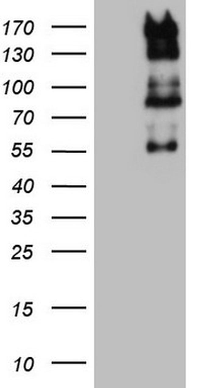 GLI1 Antibody in Western Blot (WB)