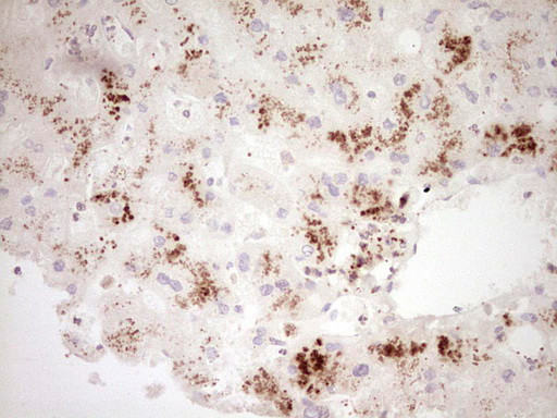 GLI4 Antibody in Immunohistochemistry (Paraffin) (IHC (P))