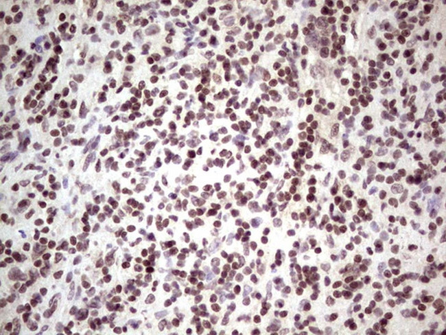 GLI4 Antibody in Immunohistochemistry (Paraffin) (IHC (P))