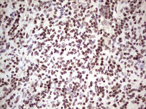 GLI4 Antibody in Immunohistochemistry (Paraffin) (IHC (P))