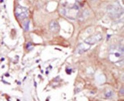 MAP4K3 Antibody in Immunohistochemistry (IHC)