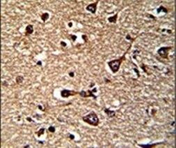 GLRX2 Antibody in Immunohistochemistry (IHC)