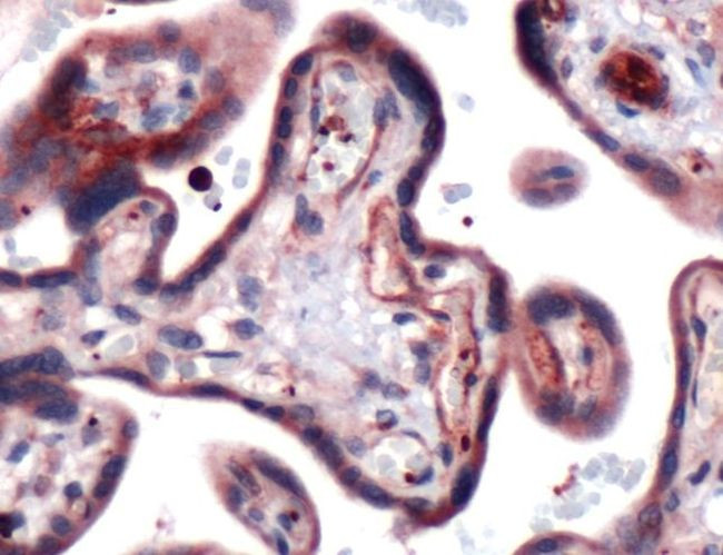 GLUT3 Antibody in Immunohistochemistry (IHC)
