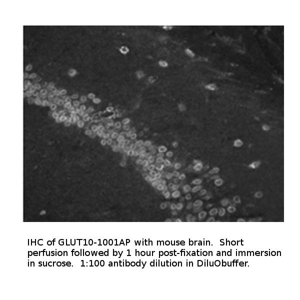 Glucose Transporter GLUT10 Antibody in Immunohistochemistry (IHC)