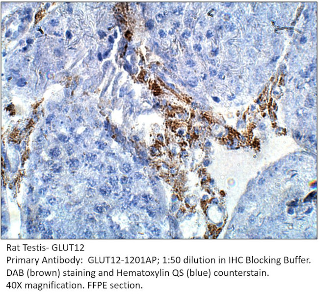 GLUT12 Antibody in Immunohistochemistry (IHC)
