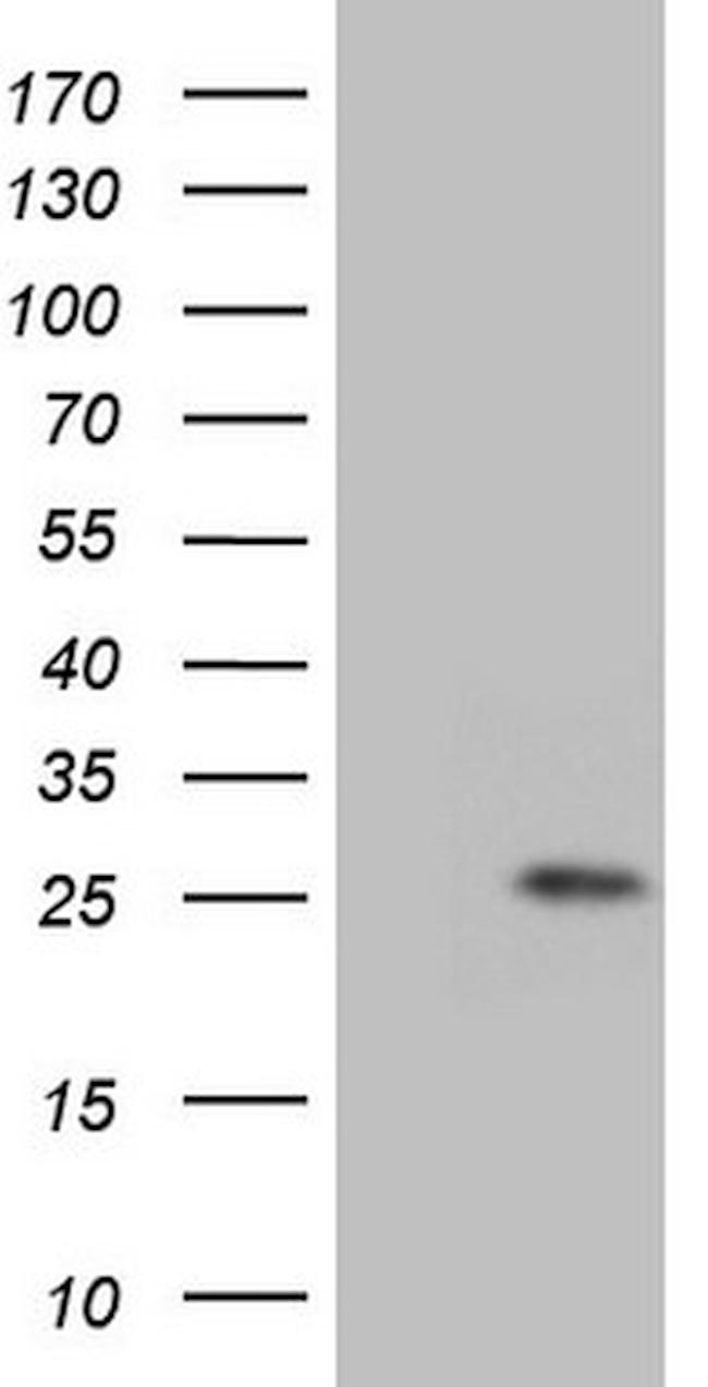 GLYAT Antibody in Western Blot (WB)