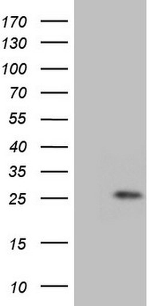 GLYAT Antibody in Western Blot (WB)