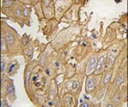 GMFG Antibody in Immunohistochemistry (IHC)
