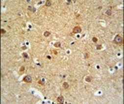 GMFG Antibody in Immunohistochemistry (IHC)