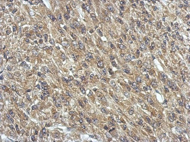 GNAQ Antibody in Immunohistochemistry (IHC)