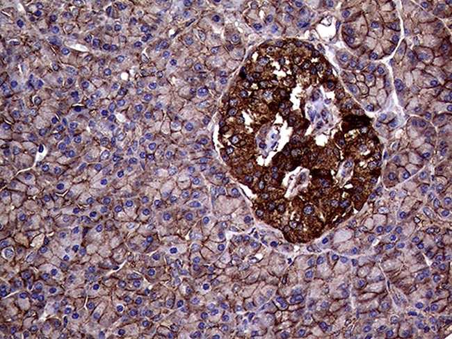 GNAS Antibody in Immunohistochemistry (Paraffin) (IHC (P))