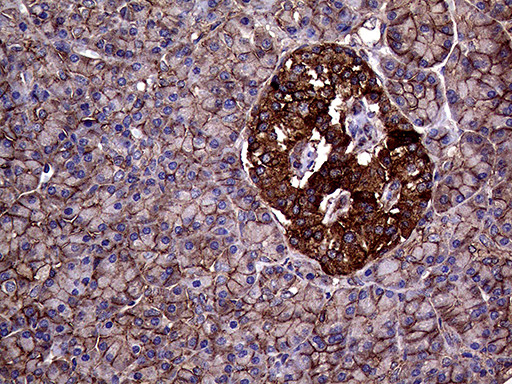 GNAS Antibody in Immunohistochemistry (Paraffin) (IHC (P))