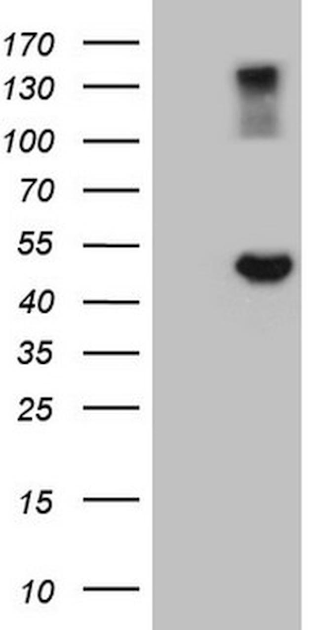 GNAS Antibody in Western Blot (WB)