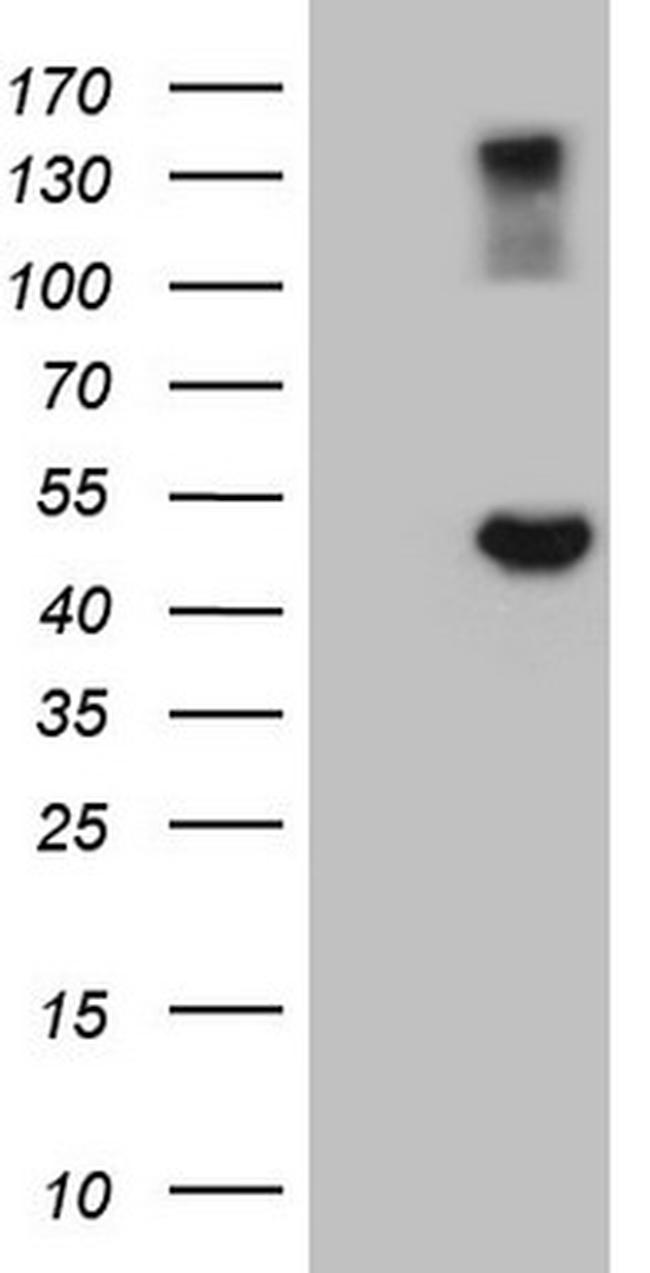 GNAS Antibody in Western Blot (WB)