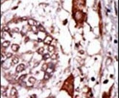 RACK1 Antibody in Immunohistochemistry (IHC)