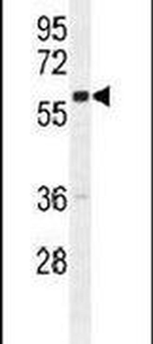 GNL3L Antibody in Western Blot (WB)