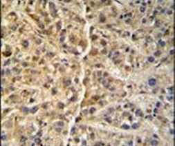 GNS Antibody in Immunohistochemistry (IHC)