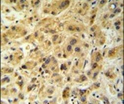 GNS Antibody in Immunohistochemistry (IHC)
