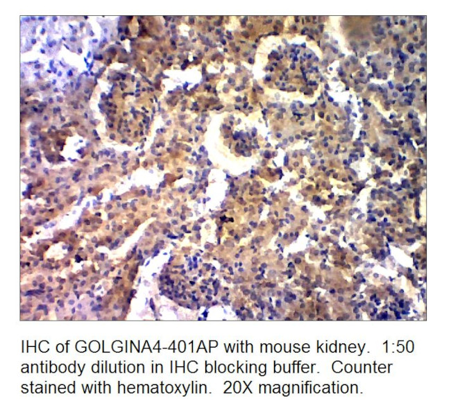 Golgin A4 Antibody in Immunohistochemistry (IHC)