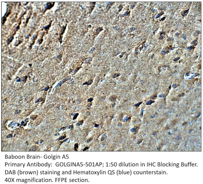 Golgin A5 Antibody in Immunohistochemistry (IHC)