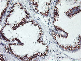 GOLM1 Antibody in Immunohistochemistry (Paraffin) (IHC (P))