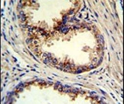 GOLPH3 Antibody in Immunohistochemistry (IHC)