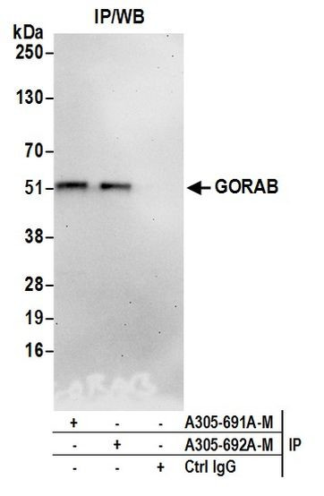 GORAB Antibody in Immunoprecipitation (IP)