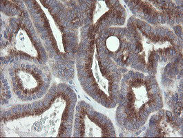 GORAB Antibody in Immunohistochemistry (Paraffin) (IHC (P))