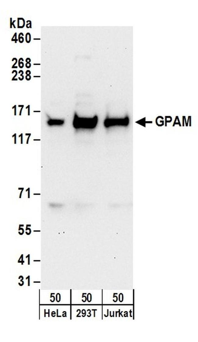 GPAM Antibody in Western Blot (WB)