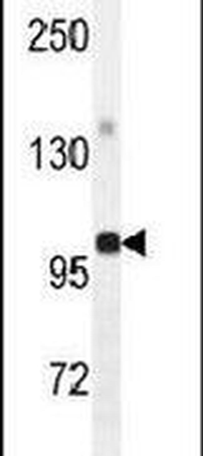 GPAM Antibody in Western Blot (WB)
