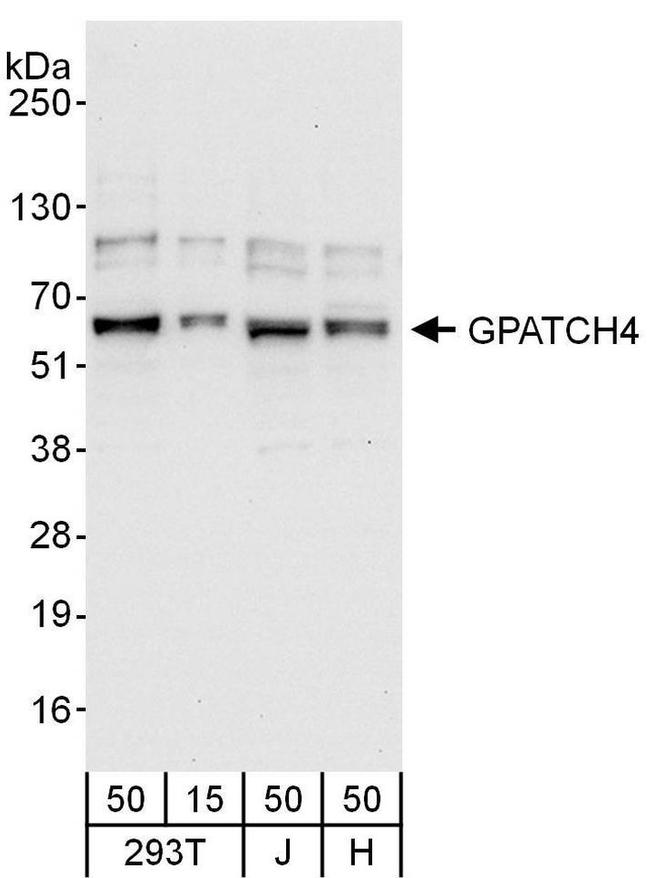 GPATCH4 Antibody in Western Blot (WB)