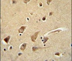 Glypican 5 Antibody in Immunohistochemistry (IHC)