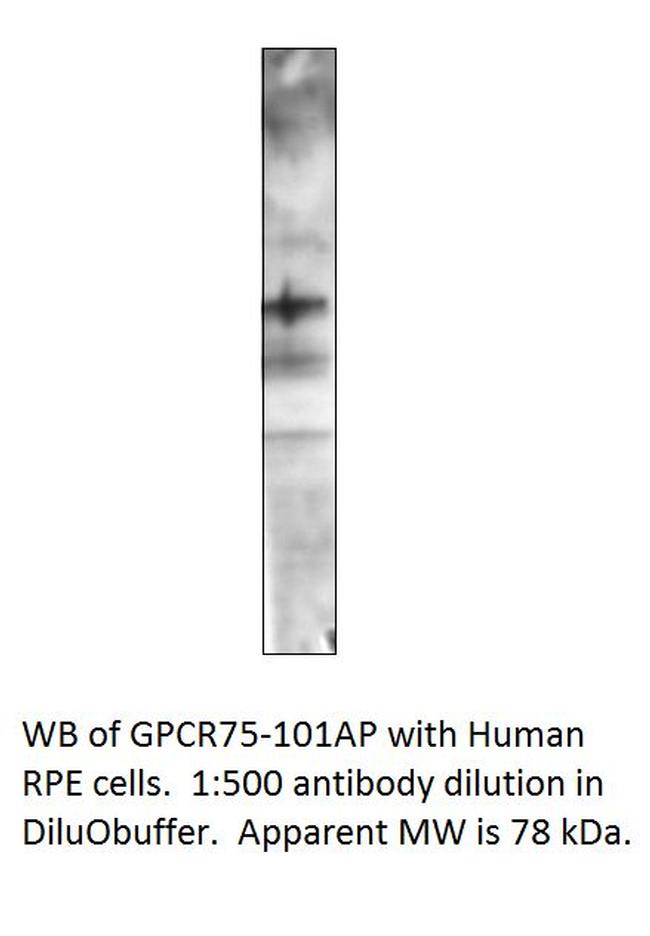 GPCR GPR75 Antibody in Western Blot (WB)