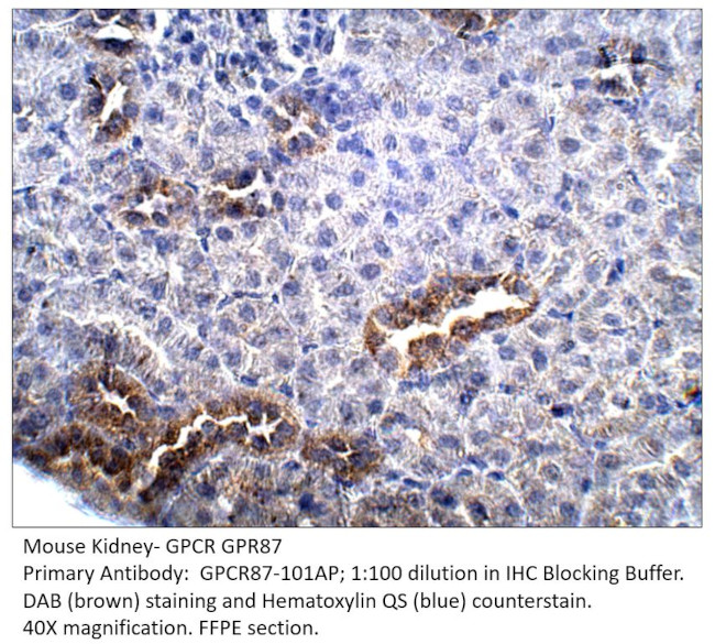 GPCR GPR87 Antibody in Immunohistochemistry (IHC)