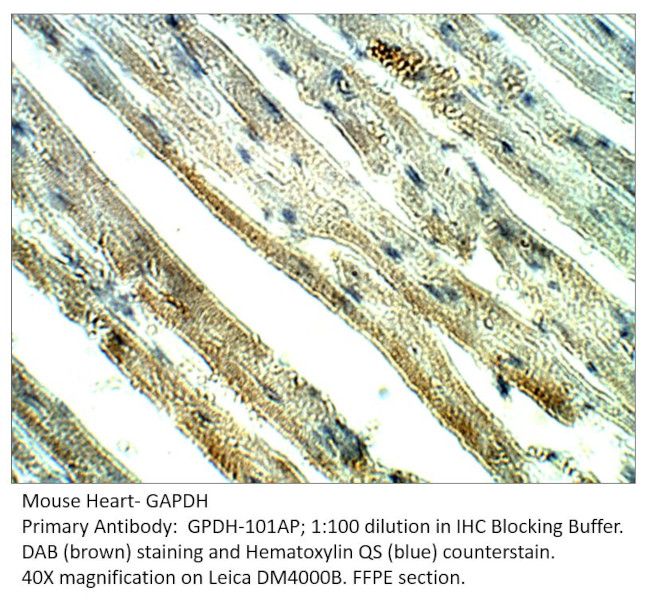 GAPDH Antibody in Immunohistochemistry (IHC)