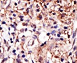 GPIP137 Antibody in Immunohistochemistry (IHC)
