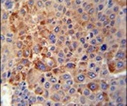 GPLD1 Antibody in Immunohistochemistry (IHC)