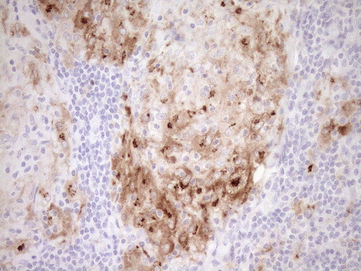 GPNMB Antibody in Immunohistochemistry (Paraffin) (IHC (P))