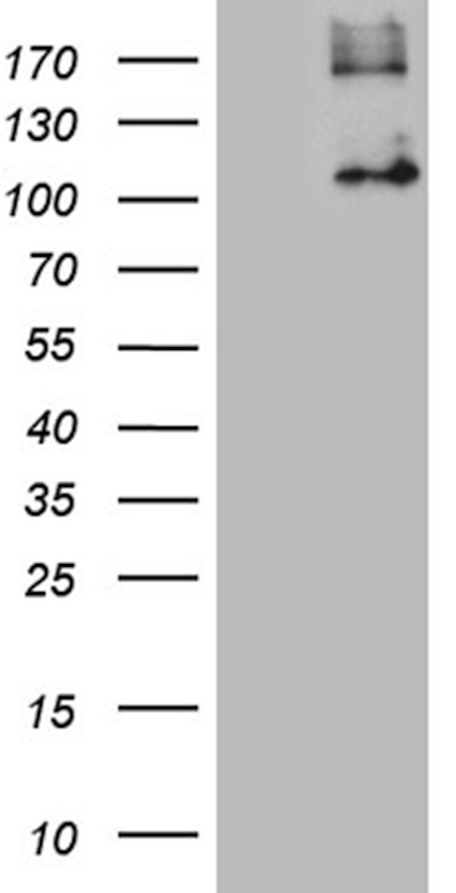 GPNMB Antibody in Western Blot (WB)