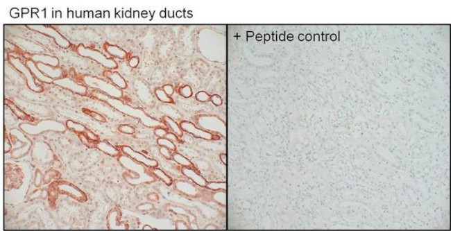 GPR1 Antibody in Immunohistochemistry (Paraffin) (IHC (P))