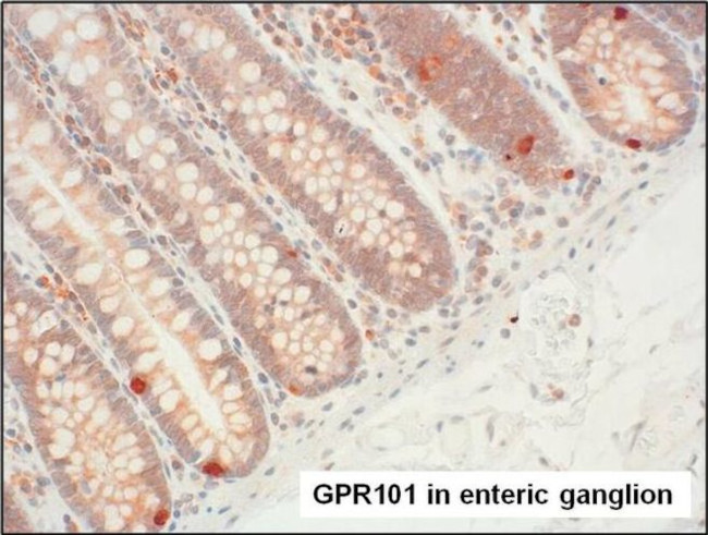 GPR101 Antibody in Immunohistochemistry (Paraffin) (IHC (P))