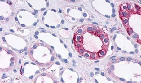 GPR108 Antibody in Immunohistochemistry (Paraffin) (IHC (P))