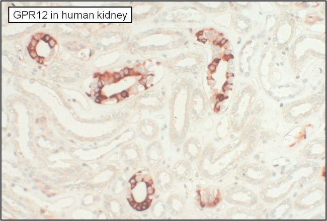 GPR12 Antibody in Immunohistochemistry (Paraffin) (IHC (P))