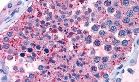 GPR133 Antibody in Immunohistochemistry (Paraffin) (IHC (P))