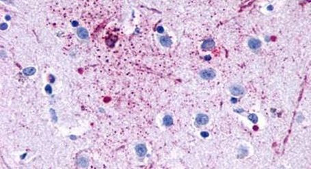 GPR139 Antibody in Immunohistochemistry (Paraffin) (IHC (P))