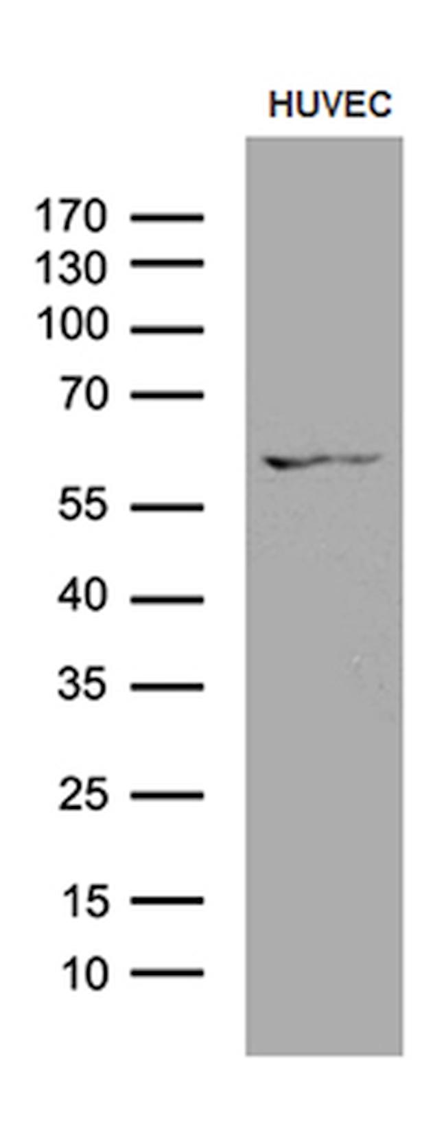 GPR151 Antibody in Western Blot (WB)
