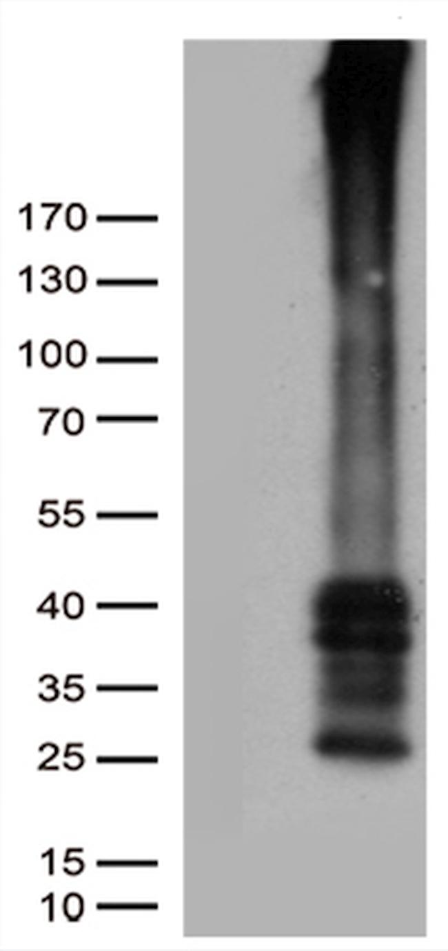 GPR151 Antibody in Western Blot (WB)
