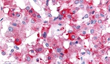 GPR152 Antibody in Immunohistochemistry (Paraffin) (IHC (P))