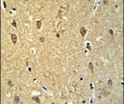 GPR17 Antibody in Immunohistochemistry (IHC)